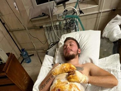 Командир групи саперів 59-ої бригади підірвався на міні, але вижив