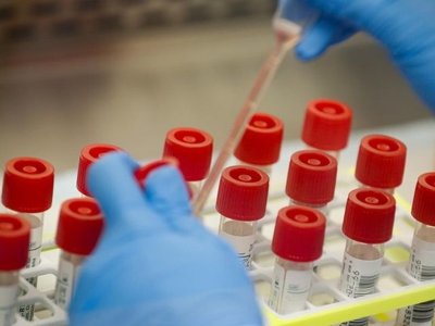 На Черкащині епідпоріг щодо грипу та ГРВІ перевищено на понад 19%