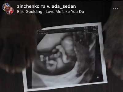 Зінченко готується до батьківства. Вдруге