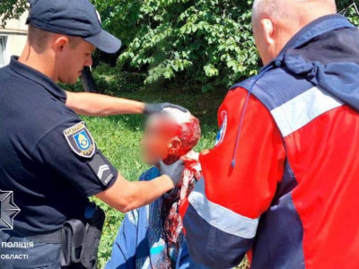 Патрульні врятували чоловіка, який стікав кров'ю на вулиці Дубна