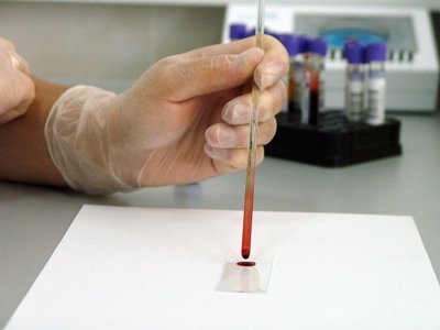 Вчені назвали групу крові з найсильнішим імунітетом
