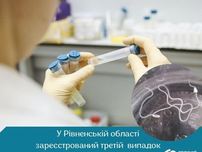 У Рівному з голови чоловіка дістали дев’ятисантиметрового черв`яка