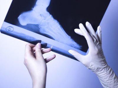 Як війна трансформує українську медицину та впливає на розвиток MedTech