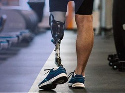 Росіяни поширюють фейк про те, що у Тернополі ломбард почав приймати протези в захисників