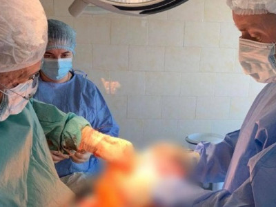 Жінці видалили пухлину вагою майже десять кілограмів. ФОТО