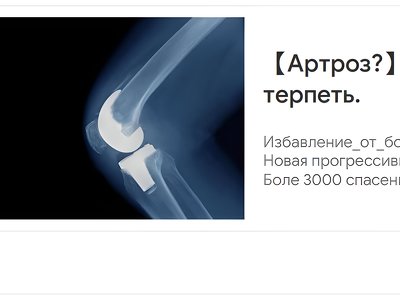 Акторка Валерія Ходос розповіла про постійну боротьбу із зайвою вагою: «Неприємно і дискомфортно»