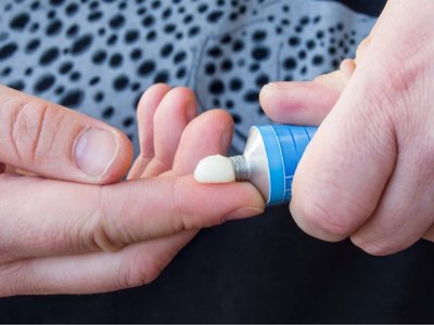 Кортикостероїди в дерматології: дія та показання