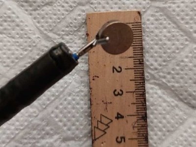 Дівчинка проковтнула батарейку: що розповів хірург (фото)