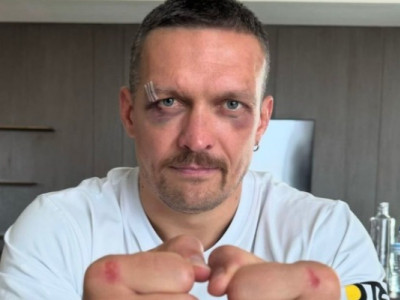 Нелегальна сторона переможного бою Усика: мільйонні збитки та ризики
