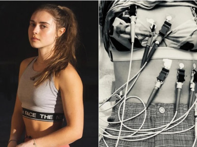 Видатна спортсменка розповіла про боротьбу з небезпечною хворобою