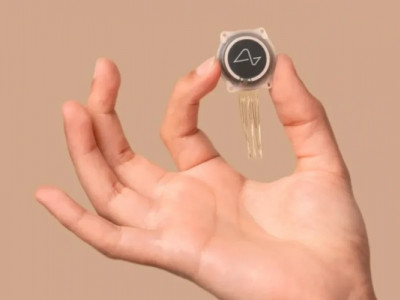Neuralink заявляє, що в мозок людини вдруге вживили чип