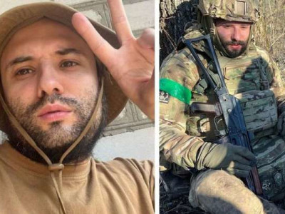 Українському коміку Віктору Розовому вставили титанову пластину в череп