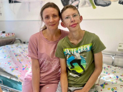 «Обличчя ельфа»: лікарі зменшили підлітку розмір губ