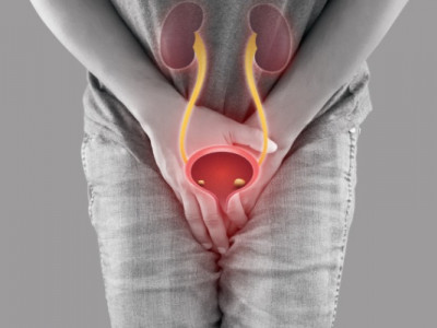 Цистит: Несподівані загрози та секрети швидкого лікування, які ви не знали!