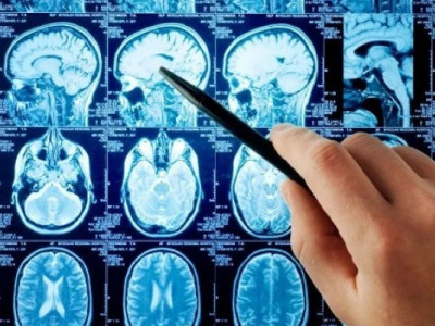 В якому віці мозок починає працювати гірше? Вчені дали неочікувану відповідь!