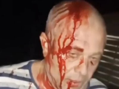 Жорстокий напад на родину українців у Польщі: шокуючі подробиці