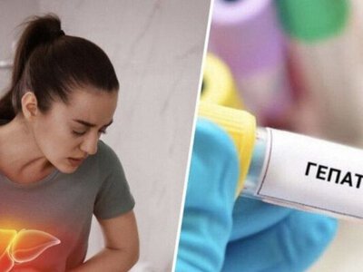 У Києві – спалах гепатиту А: фахівці виявили джерело зараження