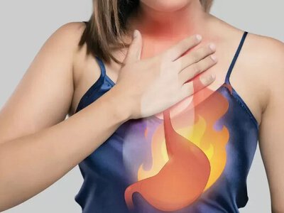 Лікарі розповіли, що робити при печії
