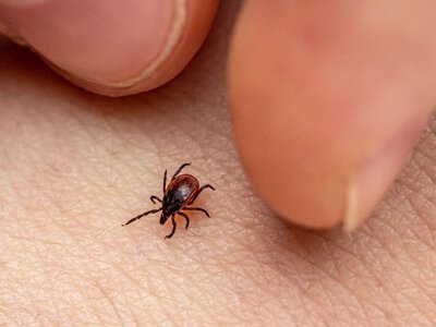 В Україні виявили кліщів зі збудником туляремії: що це за хвороба?