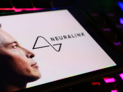 Neuralink розпочала випробування мозкових імплантів у Великій Британії