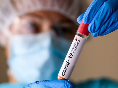 Майже вдвічі зріс показник захворювання на COVID-19 на Черкащині