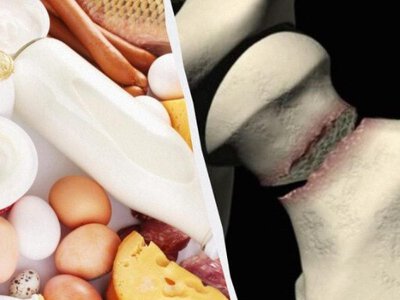Сім продуктів для зміцнення кісток