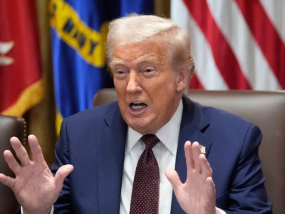 Що це за синець на руці Трампа і чому він викликає занепокоєння