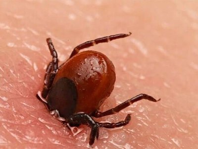 У США зафіксували першу смерть від алергії на м’ясо після укусу кліща