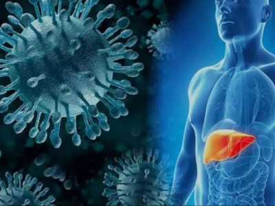 Новий спалах гепатиту А в Україні: що відомо?