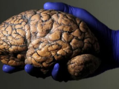 Чи триває підлітковий період до 32 років? Вчені поділили розвиток мозку на п’ять епох — нова аналітика