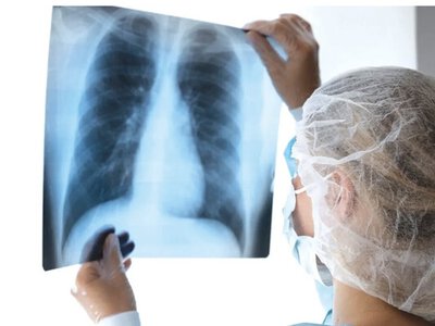 Посиніли губи чи пальці? Це може свідчити про критичну нестачу кисню в організмі