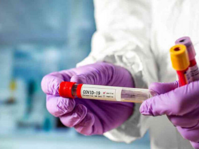 COVID-19 не збирається повертатися до Дніпропетровщини, бо йде війна