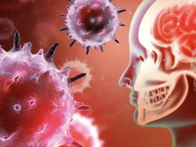 Туберкульозний менінгіт: як вчасно помітити небезпечну недугу та які шанси на одужання