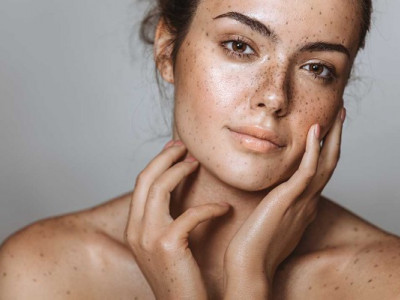 Менеджмент очікувань у корекції пігментації: роль домашнього догляду у скороченні термінів і профілактиці рецидивів