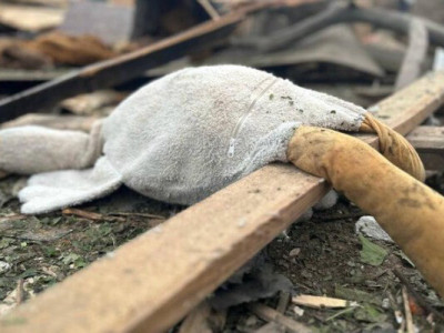 Дитина стала жертвою атаки рф на Житомирщині