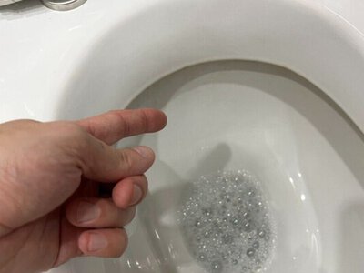 Унітаз більше не “попахує” жовтим нальотом: змішала 100 мл гарячої води з 200 г цього інгредієнту