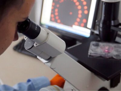 Проблема глобальна. У світі поширюється паразитарна хвороба – вражає печінку, легені та статеві органи