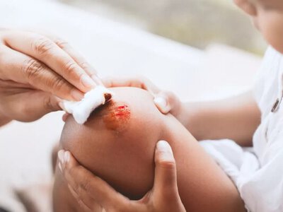 Три рослини, які допомагають загоювати рани та забої