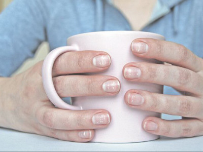 Проблеми з нігтями можуть бути ознаками раку