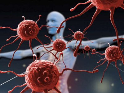 Серед покоління міленіалів шириться новий вид раку