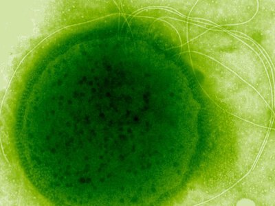 Знайдено мікроорганізм, що витримує радіацію у 6000 разів сильнішу за смертельну для людини