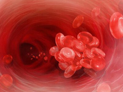 9 факторів способу життя, які можуть підвищити ризик утворення тромбів