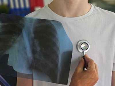 Фіксують випадки туберкульозу серед підлітків