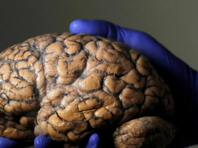 Підлітковий період триває до 32 років — відкриття вчених Кембриджу