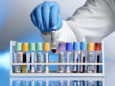 Лікар про те, які обстеження варто здати перед прийомом ендокринолога 