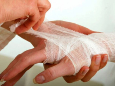 Перша допомога при опіках: що справді працює, а що робити заборонено