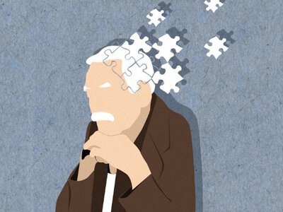 Вчені назвали симптом, який з'являється за 16 років до деменції