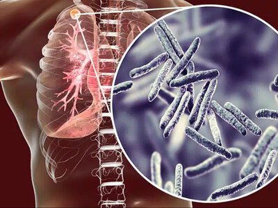 Вчені попереджають: небезпечна хвороба загрожує Україні