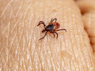 Сезон кліщів розпочався: як розпізнати хворобу Лайма та вберегтися від інфекції