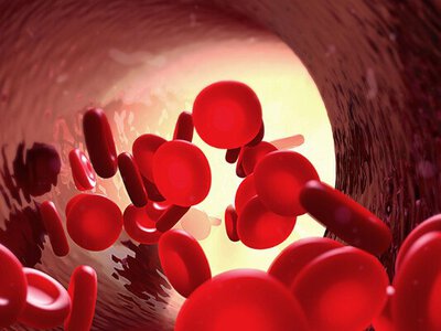 Яка група крові підвищує ризик раннього інсульту